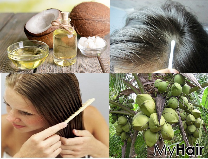 Top 5 thực phẩm giúp ngăn ngừa rụng tóc hàng đầu